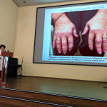 Врачебная конференция на тему «Ревматоидный артрит»